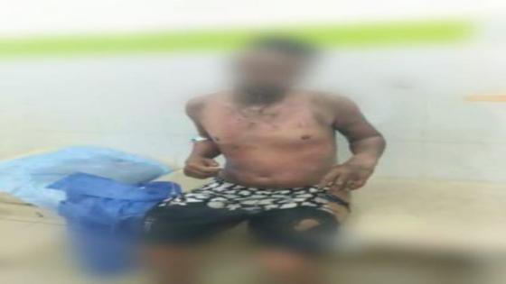 وفاة البائع المتجول الذي أضرم النار في جسده بسيدي بنور