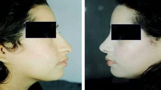 الدكتور كمال عراقي حسيني أخصائي في جراحة التقويم والتجميل وطب التجميل : أهمية الجراحة التجميلية وطب التجميل.