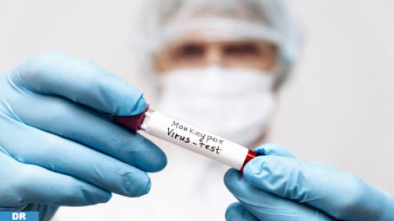 جدري القردة: عدم تسجيل أي حالة إصابة بالمغرب منذ شهور (مصدر مأذون بوزارة الصحة والحماية الاجتماعية)